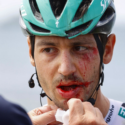 Foto zu dem Text "Buchmann scheidet nach Massencrash aus Giro d’Italia aus"